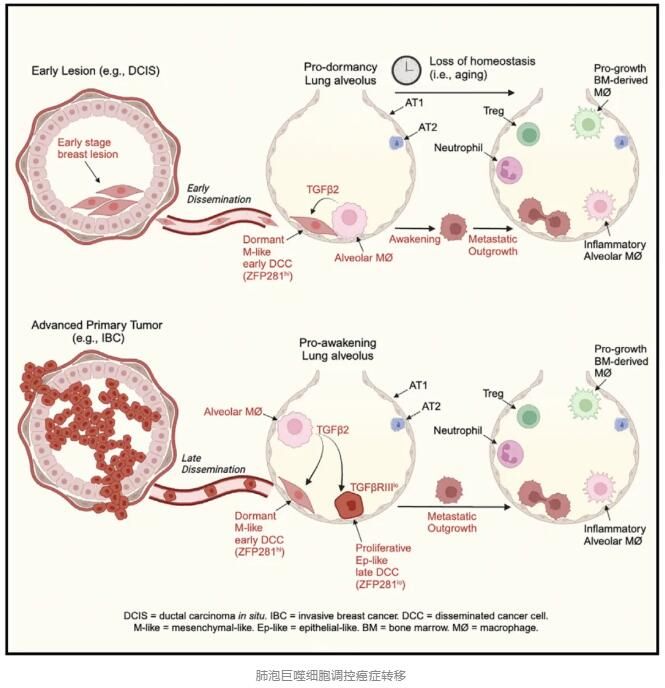 肺泡巨噬细胞调控癌症转移